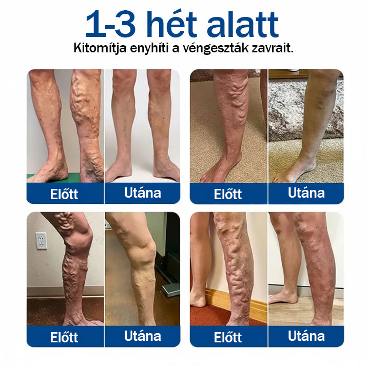 ✨🌿 Medistart® mikroneedling obliž za nego krčnih žil ⚡ Takojšnje olajšanje, dolgotrajni rezultati