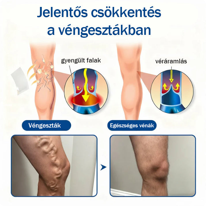 ✨🌿 Medistart® mikroneedling obliž za nego krčnih žil ⚡ Takojšnje olajšanje, dolgotrajni rezultati